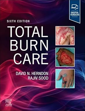 دانلود کتاب Total Burn Care