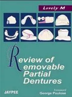 دانلود کتاب Review of Removable Partial Dentures