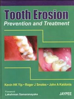 دانلود کتاب Tooth Erosion Prevention and Treatment