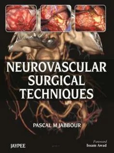 دانلود کتاب Neurovascular Surgical Techniques