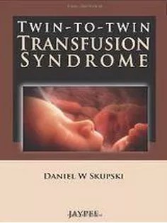 دانلود کتاب Twin-To-Twin Transfusion Syndrome