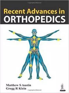 دانلود کتاب Recent Advances in Orthopedics