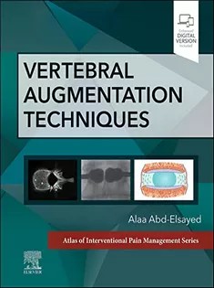دانلود کتاب Vertebral Augmentation Techniques