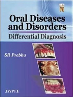 دانلود کتاب Oral Diseases and Disorders: Differential Diagnosis