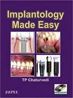 دانلود کتاب Implantology Made Easy