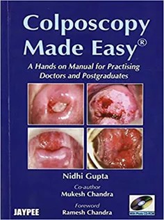 دانلود کتاب Colposcopy Made Easy