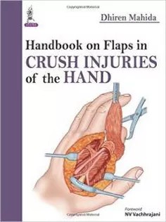 دانلود کتاب Handbook on Flaps in Crush Injuries of the Hand