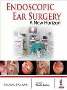 دانلود کتاب Endoscopic Ear Surgery: A New Horizon
