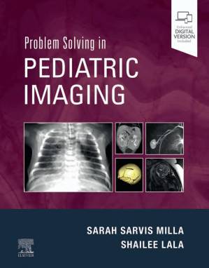 دانلود کتاب Problem Solving in Pediatric Imaging E-Book