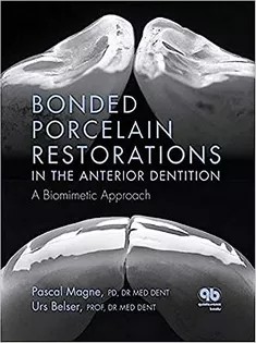 دانلود کتاب Bonded Porcelain Restorations in the Anterior Dentition