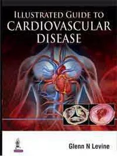 دانلود کتاب Illustrated Guide to Cardiovascular Disease