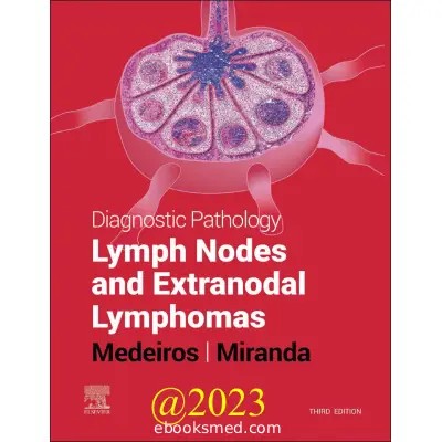 Diagnostic Pathology Lymph Nodes 3rd Edition 2023