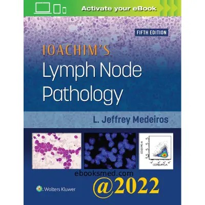 Ioachim’s Lymph Node Pathology 5th Edition 2021