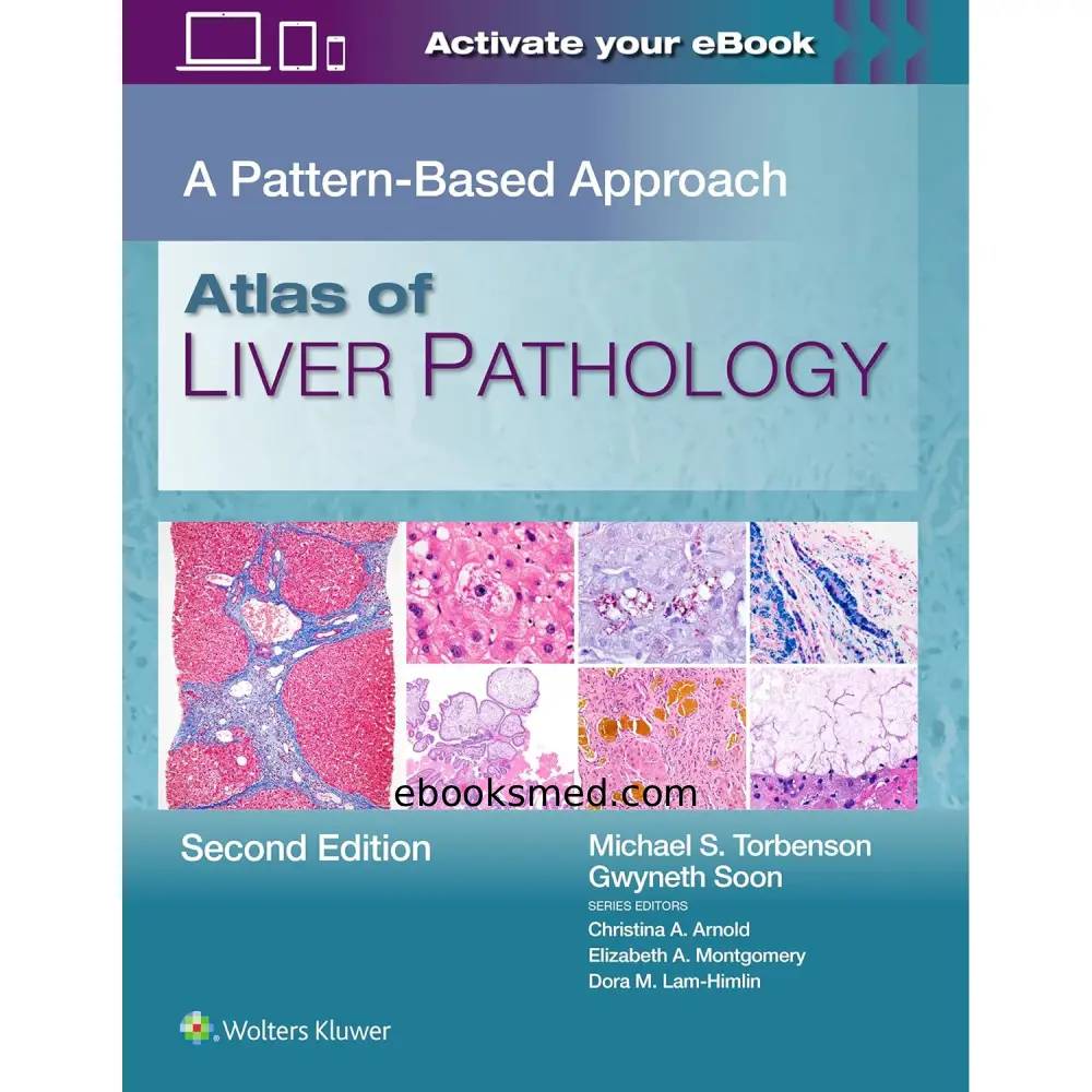 Atlas of Liver Pathology | A Pattern-Based Approach, 2nd Edition 2026