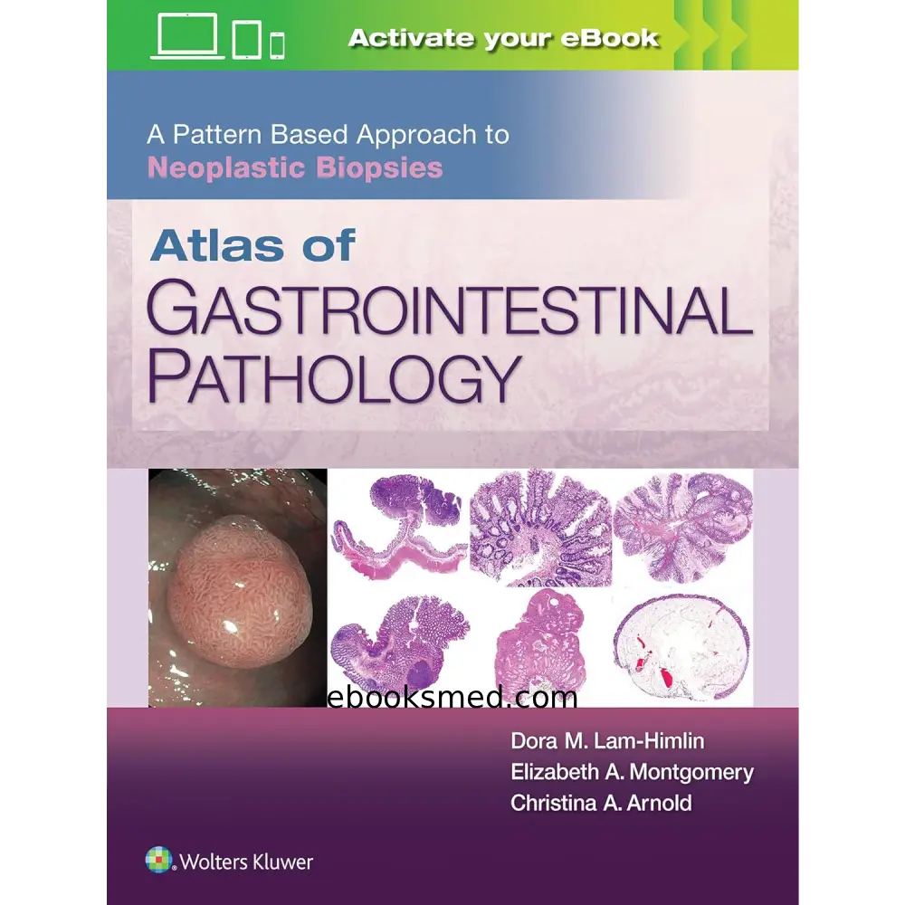 Atlas of Gastrointestinal Pathology | A Pattern Based Approach to Neoplastic Biopsies 2019