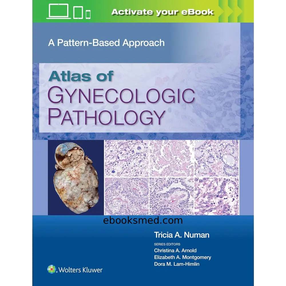 Atlas of Gynecologic Pathology | Pattern-Based Approach 2024