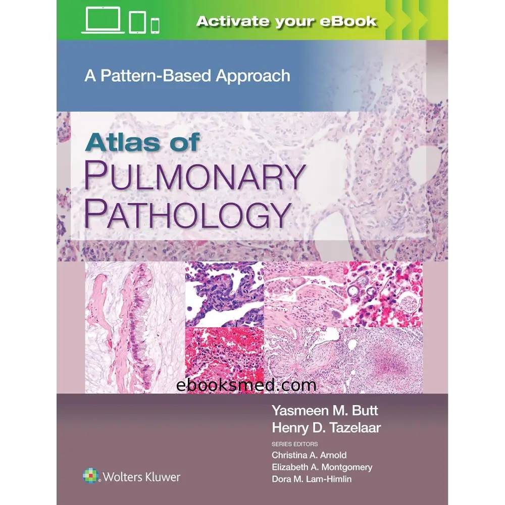 Atlas of Pulmonary Pathology 1st Edition | Pattern-Based Guide 2021