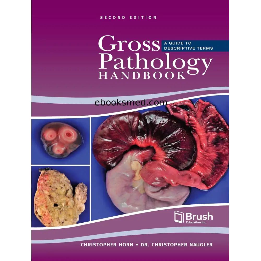 Gross Pathology Handbook 2nd Edition | Descriptive Terms Guide 2021