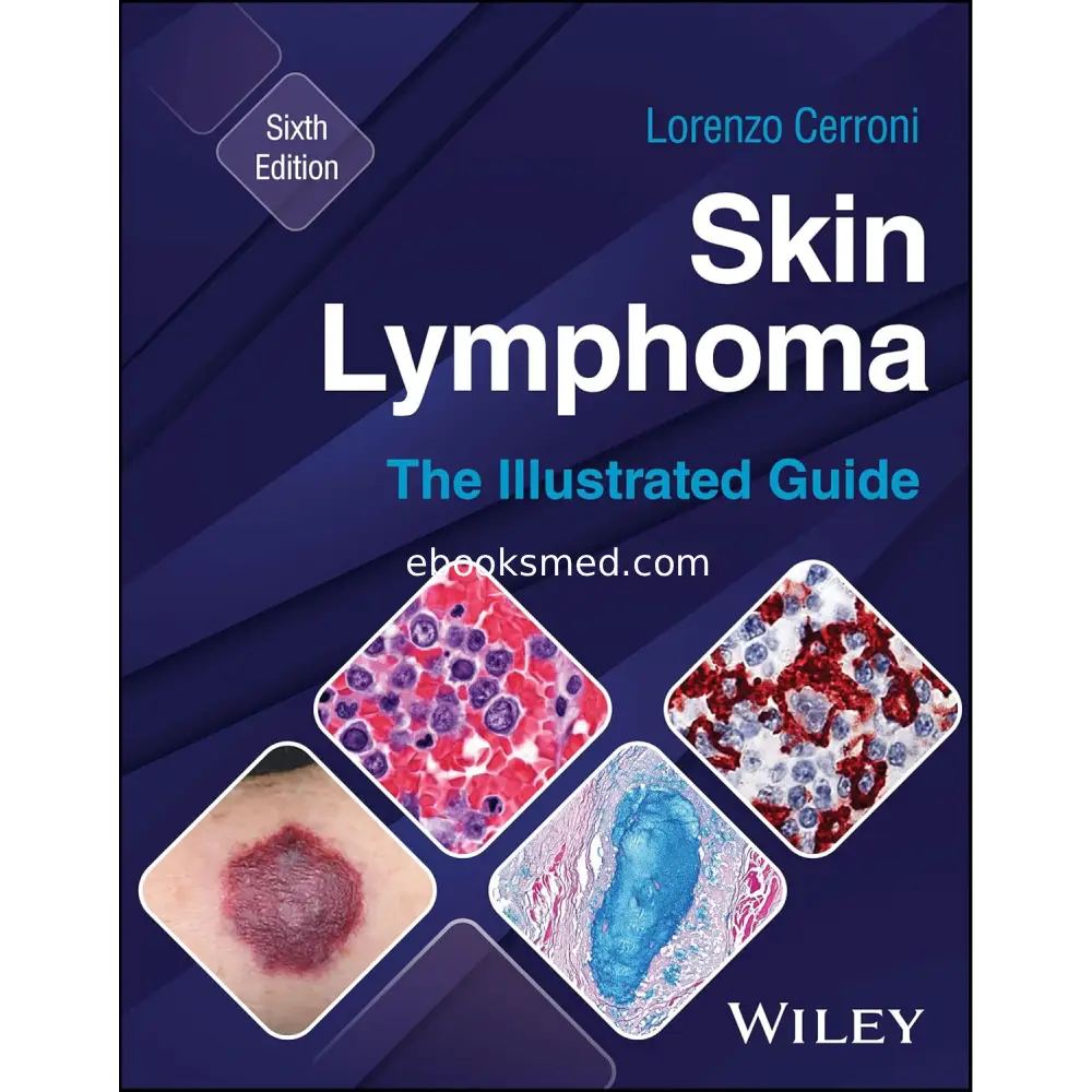 Skin Lymphoma: The Illustrated Guide 6th Edition 2026