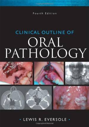 دانلود کتاب Clinical Outline of Oral Pathology: Diagnosis and Treatment