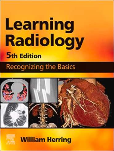 دانلود کتاب Learning Radiology: Recognizing the Basics 5th Edition + Video