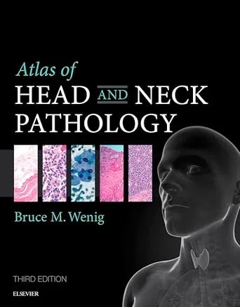 دانلود نسخه کامل کتاب Atlas of Head and Neck Pathology (Atlas of Surgical Pathology)