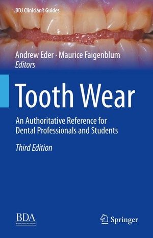 دانلود کتاب Tooth wear: an authoritative reference for dental professionals and students