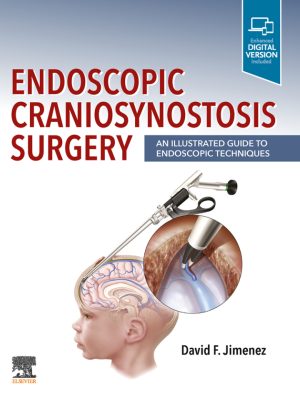 دانلود کتاب Endoscopic Craniosynostosis Surgery: An Illustrated Guide to Endoscopic Techniques