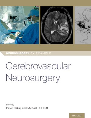 دانلود کتاب Cerebrovascular Neurosurgery-Oxford University Press
