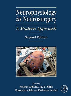 دانلود کتاب MCU Neurophysiology in Neurosurgery A Modern Approach 2nd Edition