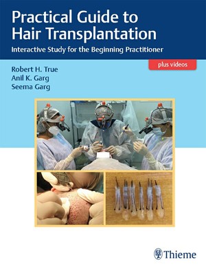 دانلود کتاب Practical Guide to Hair Transplantation –