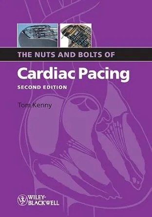 دانلود نسخه کامل کتاب The Nuts and Bolts of Cardiac Pacing (Nuts and Bolts Series (Replaced by 5113) Book 12)