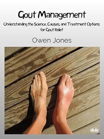 دانلود نسخه کامل کتاب Gout Management: Understanding The Science, Causes, And Treatment Options For Gout Relief
