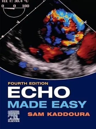 دانلود نسخه کامل کتاب Echo Made Easy , E-Book