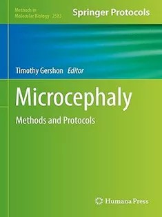 دانلود کتاب Microcephaly: Methods and Protocols