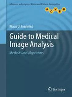 دانلود کتاب Guide to Medical Image Analysis: Methods and Algorithms