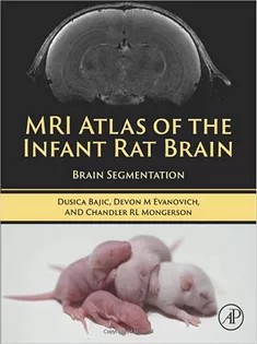 دانلود کتاب MRI Atlas of the Infant Rat Brain: Brain Segmentation