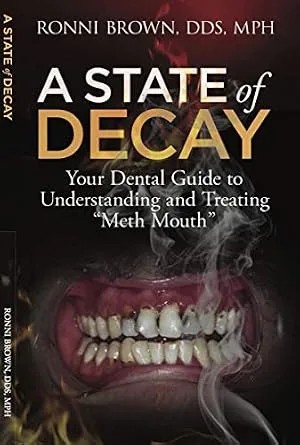 دانلود نسخه کامل کتاب A State of Decay: Your Dental Guide to Understanding and Treating “Meth Mouth”