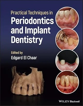 دانلود نسخه کامل کتاب Practical Techniques in Periodontics and Implant Dentistry