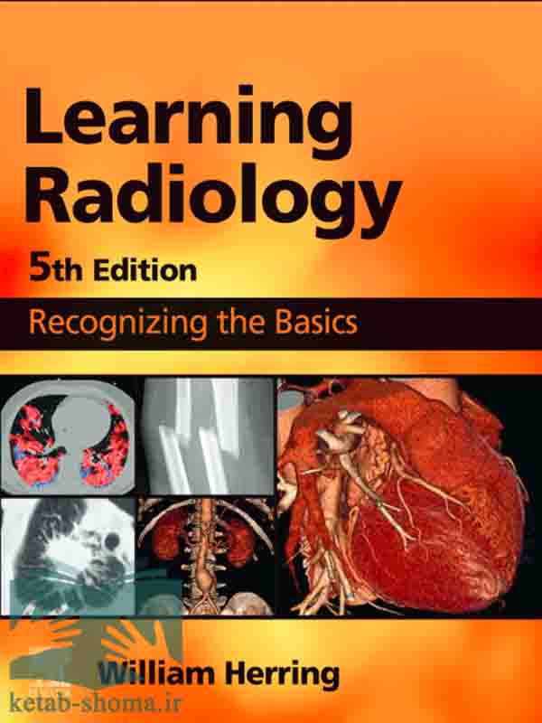 کتاب رادیولوژی هرینگ(ویراست5)(Learning Radiology: Recognizing the Basics)