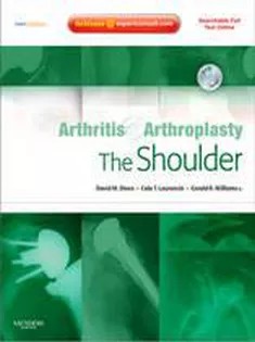 دانلود کتاب Arthritis And Arthroplasty: The Shoulder