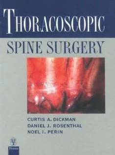دانلود کتاب Thoracoscopic Spine Surgery