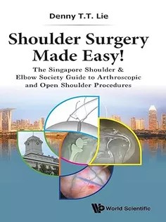 دانلود کتاب Shoulder Surgery Made Easy!: The Singapore Shoulder & Elbow Society Guide to Arthroscopic and Open Shoulder Procedures
