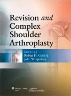 دانلود کتاب Revision and Complex Shoulder Arthroplasty