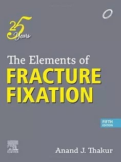 دانلود کتاب The Elements of Fracture Fixation