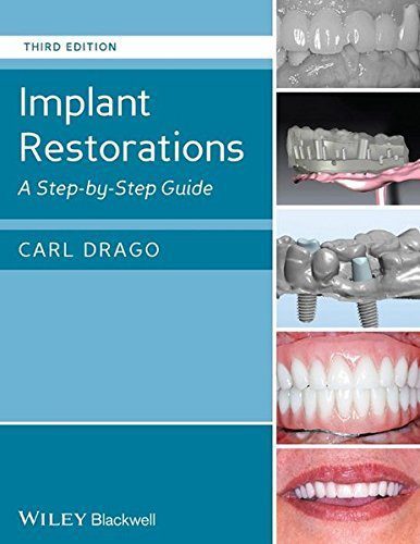 دانلود کتاب Implant Restorations: A Step-by-Step Guide (3rd Edition)
