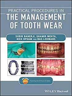 دانلود کتاب Practical Procedures in the Management of Tooth Wear
