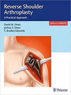دانلود کتاب Reverse Shoulder Arthroplasty: A Practical Approach