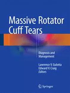 دانلود کتاب Massive Rotator Cuff Tears: Diagnosis and Management