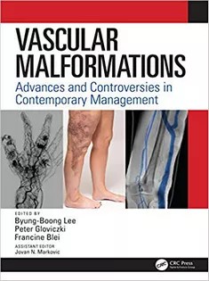 دانلود کتاب Vascular Malformations